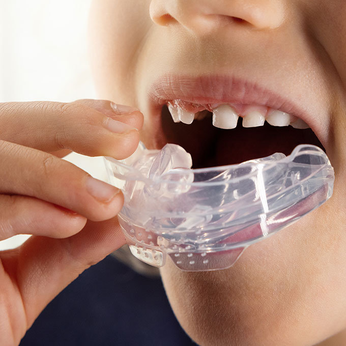 Child putting a mouth guard into mouth